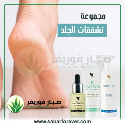 تشققات الجسم