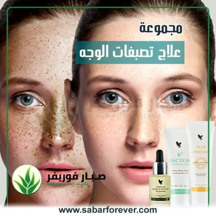 علاج تصبغات الوجه