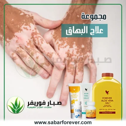 علاج البهاق